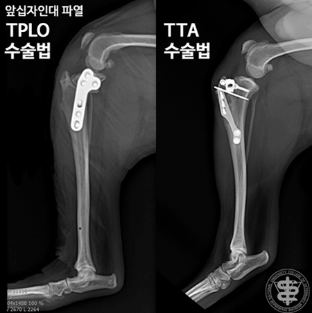 앞십자인대 파열 TPLO수술법, TTA수술법
