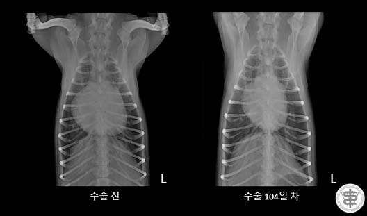 방사선 사진