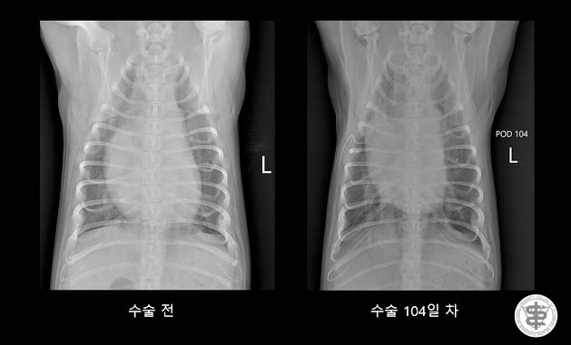 방사선 사진