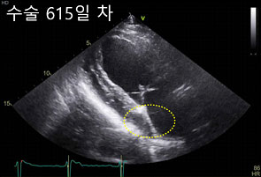 초음파 영상 사진