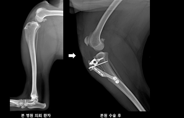 TTA(정강뼈 거친면 앞옮김술) 수술 전 및 수술 후 사진